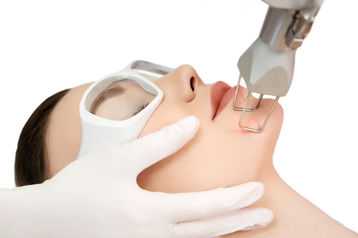 Điều trị sẹo lâu năm tại thẩm mỹ viện Mộc Linh Hải tại Thẩm Mỹ Mộc Linh Hải Phòng - hình 3