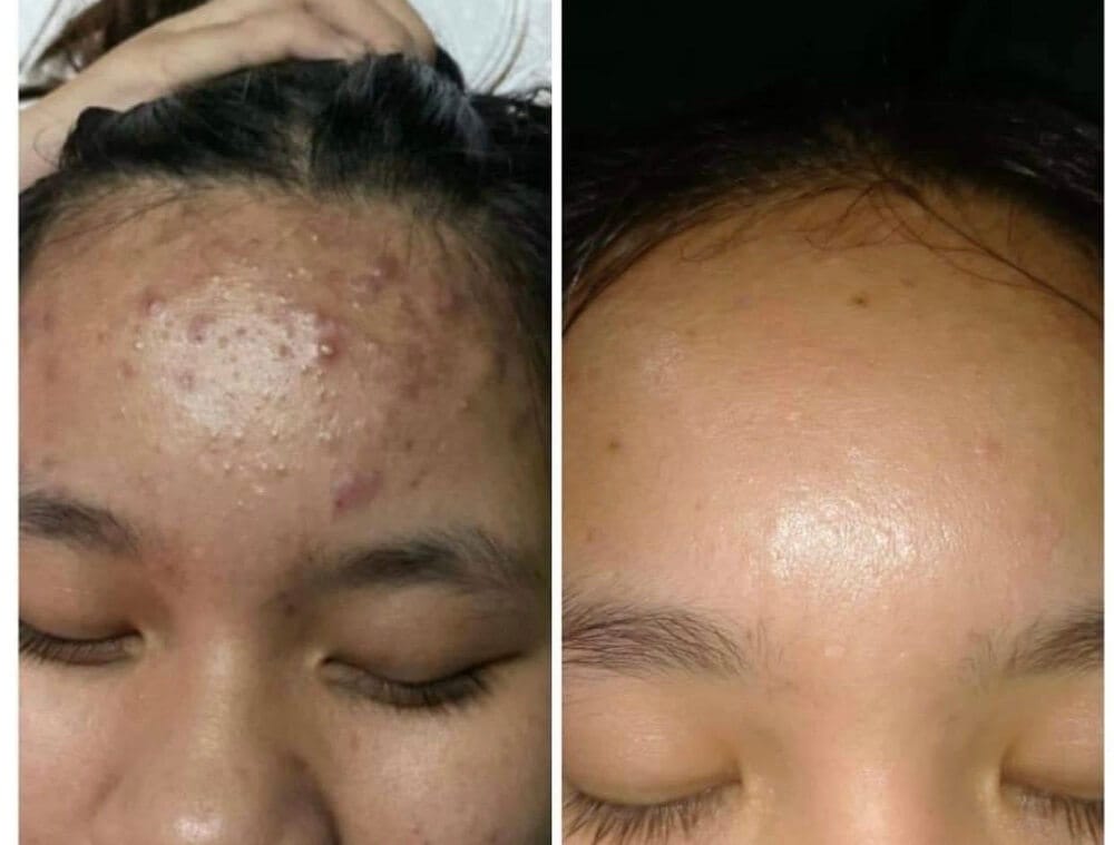 Hình ảnh thực tế tại Thẩm Mỹ Mộc Linh Hải Phòng