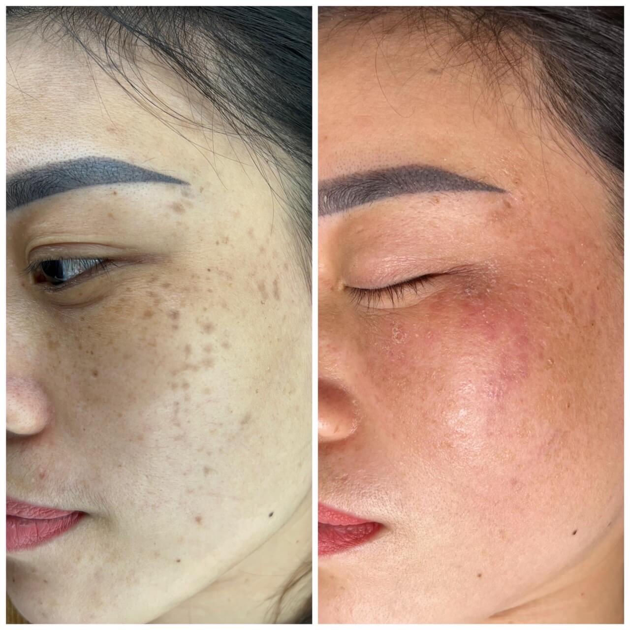 Hình ảnh thực tế tại Thẩm Mỹ Mộc Linh Hải Phòng