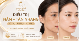 Trị nám/tàn nhang uy tín tại Hải Phòng tại Thẩm Mỹ Mộc Linh - hình 23
