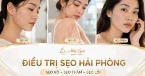 Điều trị các loại sẹo uy tín Hải Phòng tại Thẩm Mỹ Mộc Linh - hình 5