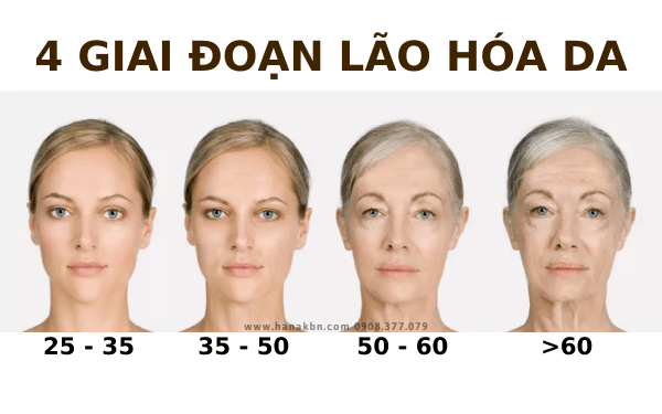 Điều trị da nhờn & lỗ chân lông tại Thẩm Mỹ Mộc Linh Hải Phòng - hình 4
