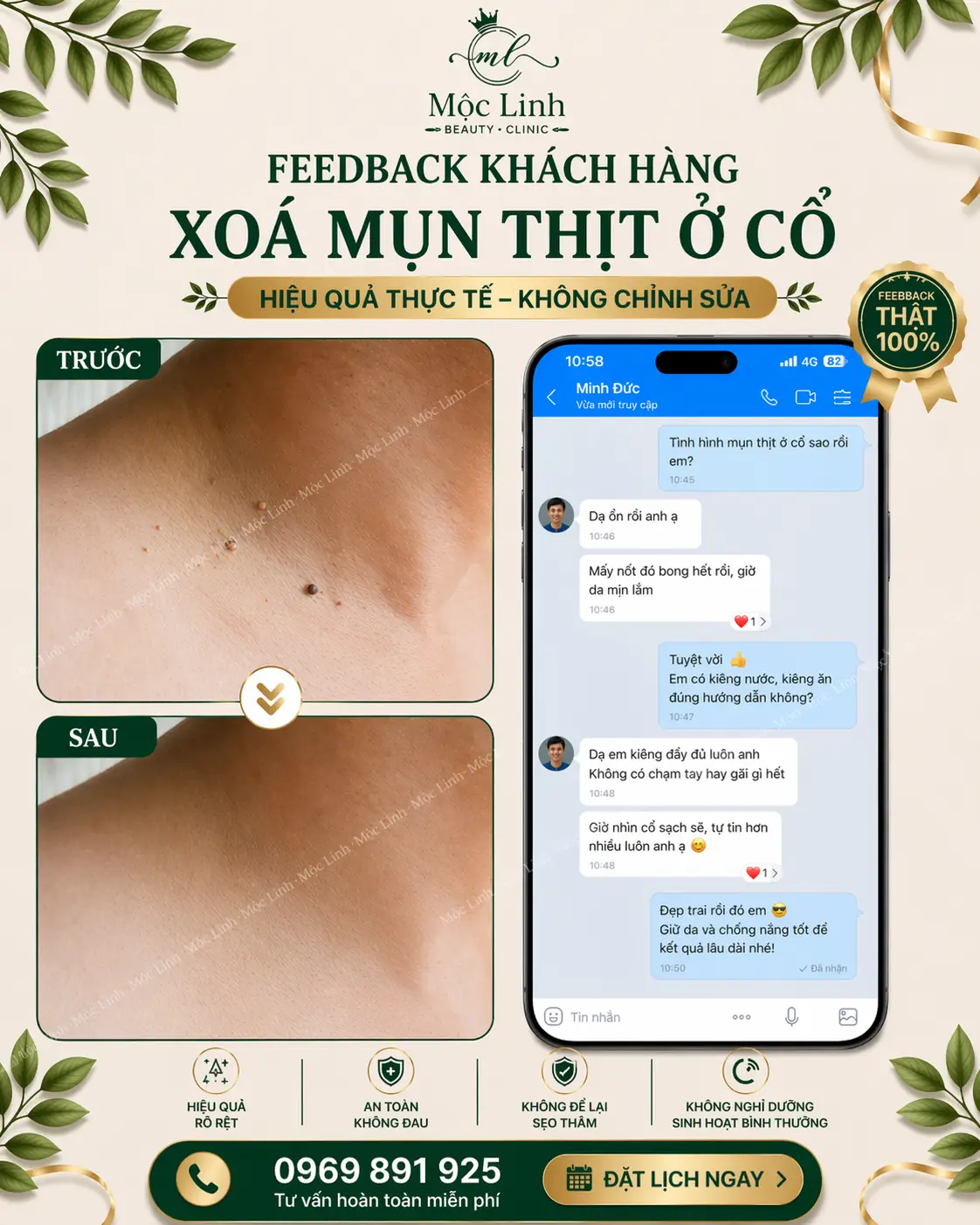 Tẩy nốt ruồi, mụn cơm, mụn thịt tại Thẩm Mỹ Mộc Linh Hải Phòng - hình 11