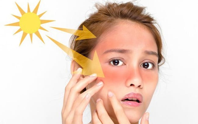Điều trị da nhờn & lỗ chân lông tại Thẩm Mỹ Mộc Linh Hải Phòng - hình 3
