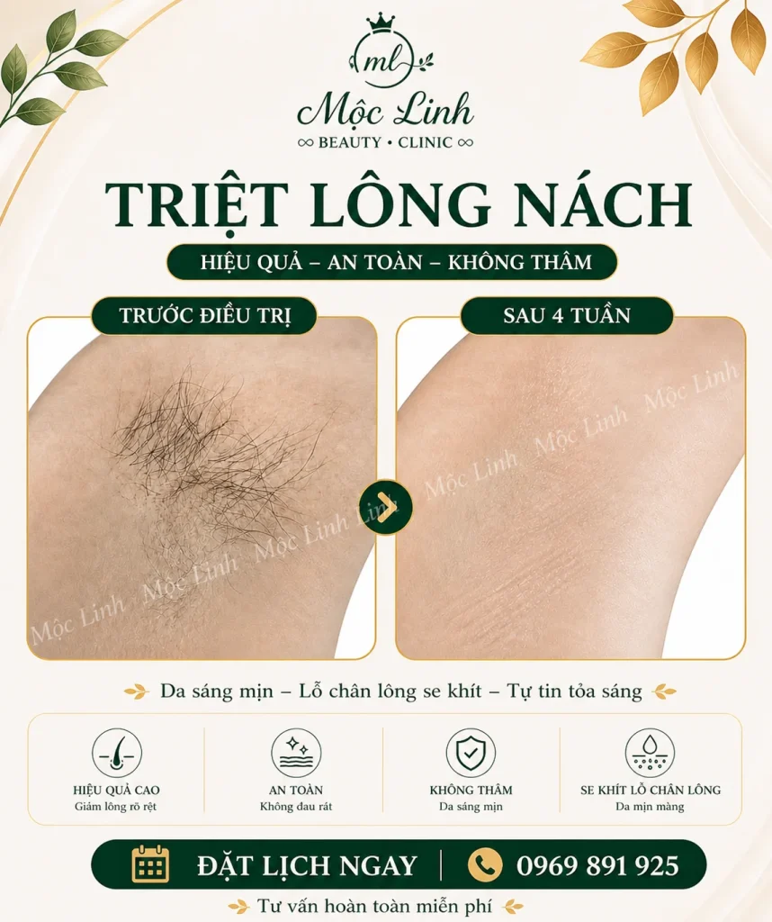 Triệt Lông Hải Phòng tại Thẩm Mỹ Mộc Linh - hình 15