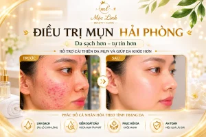Trị Mụn Số 1 Hải Phòng tại Thẩm Mỹ Mộc Linh - hình 9