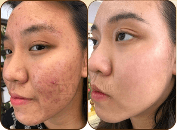 Đào Tạo Điều Trị Da Cơ Bản - Nâng Cao Tại Thẩm Mỹ Viện tại Thẩm Mỹ Mộc Linh Hải Phòng - hình 3