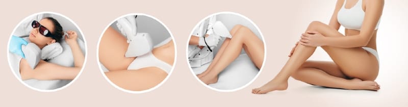 Full Body Hair Removal tại Thẩm Mỹ Mộc Linh Hải Phòng - hình 2