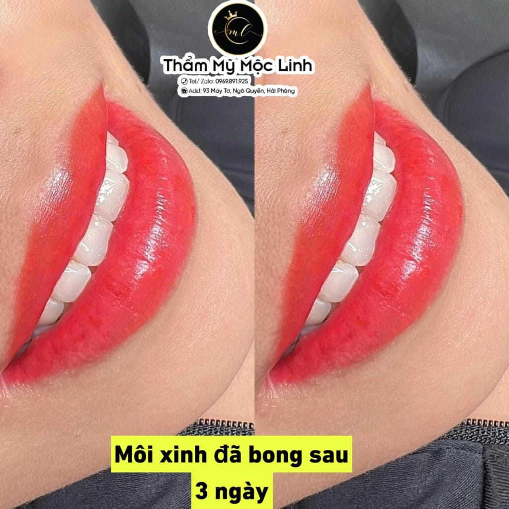Xăm môi (Phun môi) tại Thẩm Mỹ Mộc Linh Hải Phòng - hình 2