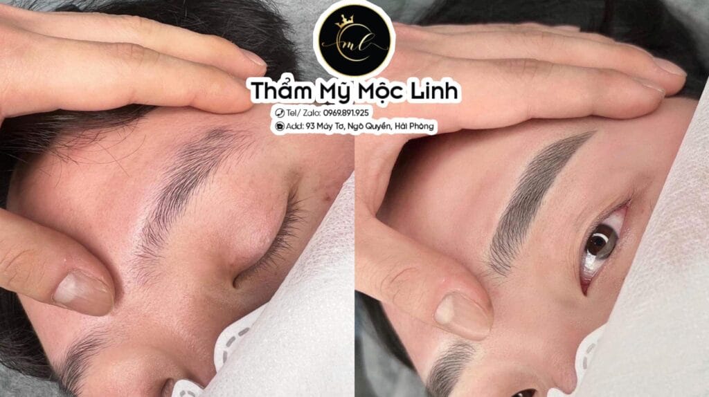 Phun mày tại Thẩm Mỹ Mộc Linh Hải Phòng - hình 4