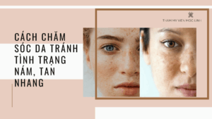 Cách chăm sóc da tránh tình trạng nám, tàn nhang tại Thẩm Mỹ Mộc Linh Hải Phòng - hình 1