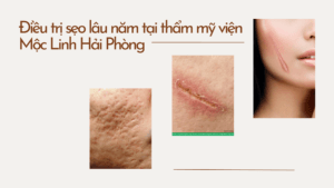Điều trị sẹo lâu năm tại thẩm mỹ viện Mộc Linh Hải tại Thẩm Mỹ Mộc Linh Hải Phòng - hình 2