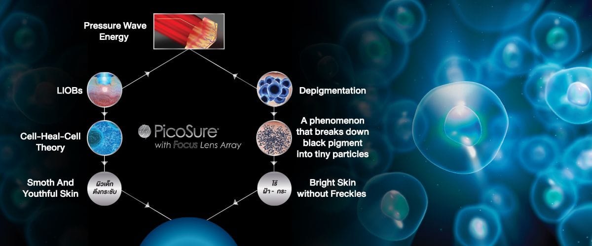 Chuyển giao công nghệ làm đẹp bằng Laser hiện đại tại Thẩm Mỹ Mộc Linh Hải Phòng - hình 4