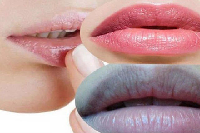 Công nghệ khử thâm môi tiên tiến nhất hiện nay có tại tại Thẩm Mỹ Mộc Linh Hải Phòng - hình 1