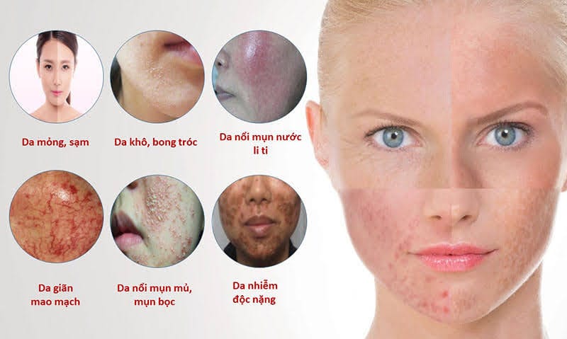 Kem trộn và những điều bạn cần biết tại Thẩm Mỹ Mộc Linh Hải Phòng - hình 2