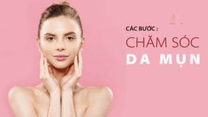 Thói quen tốt khi chăm sóc da dầu tại Thẩm Mỹ Mộc Linh Hải Phòng - hình 3