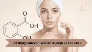 Sử dụng Salicylic Acid để trị mụn có an toàn ? tại Thẩm Mỹ Mộc Linh Hải Phòng - hình 2