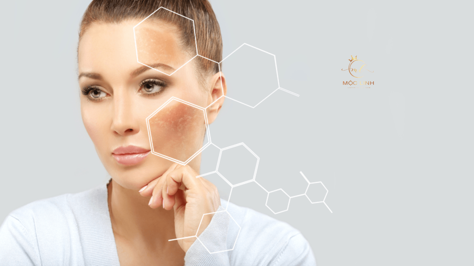 Hydroquinone là gì ? Các công dụng, liều dùng và tác tại Thẩm Mỹ Mộc Linh Hải Phòng - hình 1