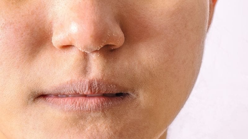 Cách chọn kem dưỡng ẩm ban ngày cho từng loại da tại Thẩm Mỹ Mộc Linh Hải Phòng - hình 3