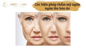 Các biện pháp thẩm mỹ ngăn ngừa lão hóa da tại Thẩm Mỹ Mộc Linh Hải Phòng - hình 6