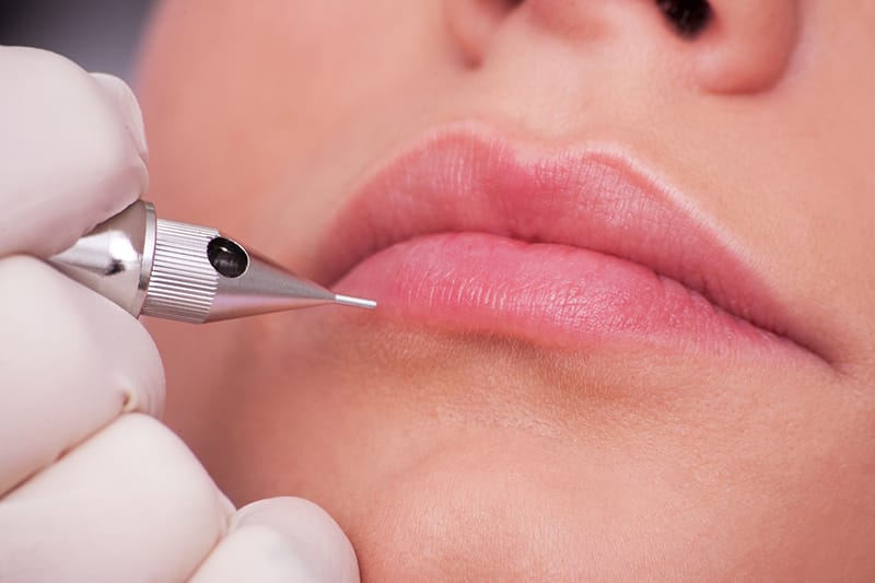 Khử Thâm Môi, Giúp Môi Hồng Hào Tự Nhiên tại Thẩm Mỹ Mộc Linh Hải Phòng - hình 2