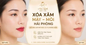 Xoá xăm mày - môi Hải Phòng tại Thẩm Mỹ Mộc Linh - hình 15