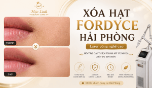 Xoá hạt Fordyce Hải Phòng tại Thẩm Mỹ Mộc Linh - hình 2