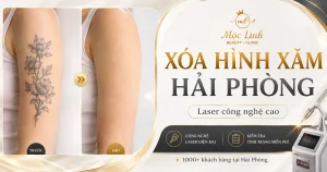 Xoá hình xăm Hải Phòng tại Thẩm Mỹ Mộc Linh - hình 1