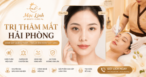 Chữa thâm mắt uy tín Hải Phòng tại Thẩm Mỹ Mộc Linh - hình 1