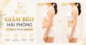 Giảm Béo An Toàn Hải Phòng tại Thẩm Mỹ Mộc Linh - hình 5
