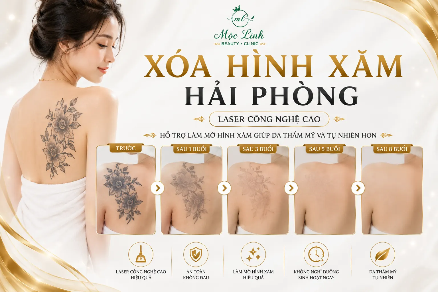 Xoá hình xăm Hải Phòng tại Thẩm Mỹ Mộc Linh - hình 1