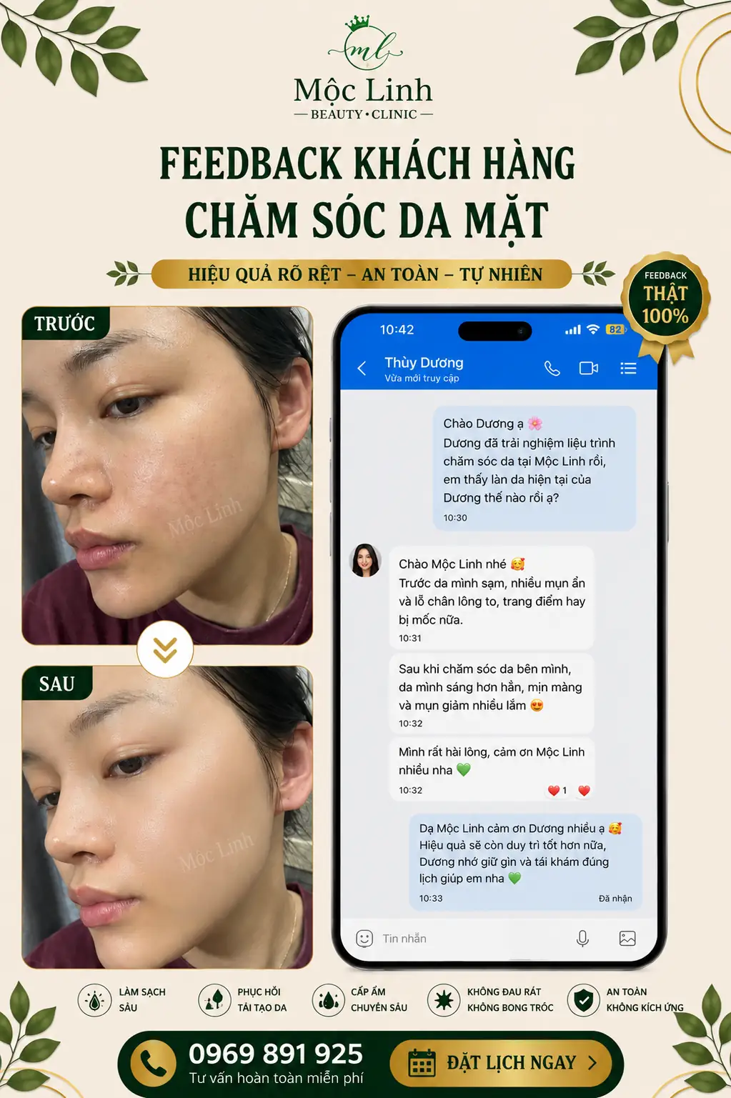 Chăm sóc da mặt tại Thẩm Mỹ Mộc Linh Hải Phòng - hình 7