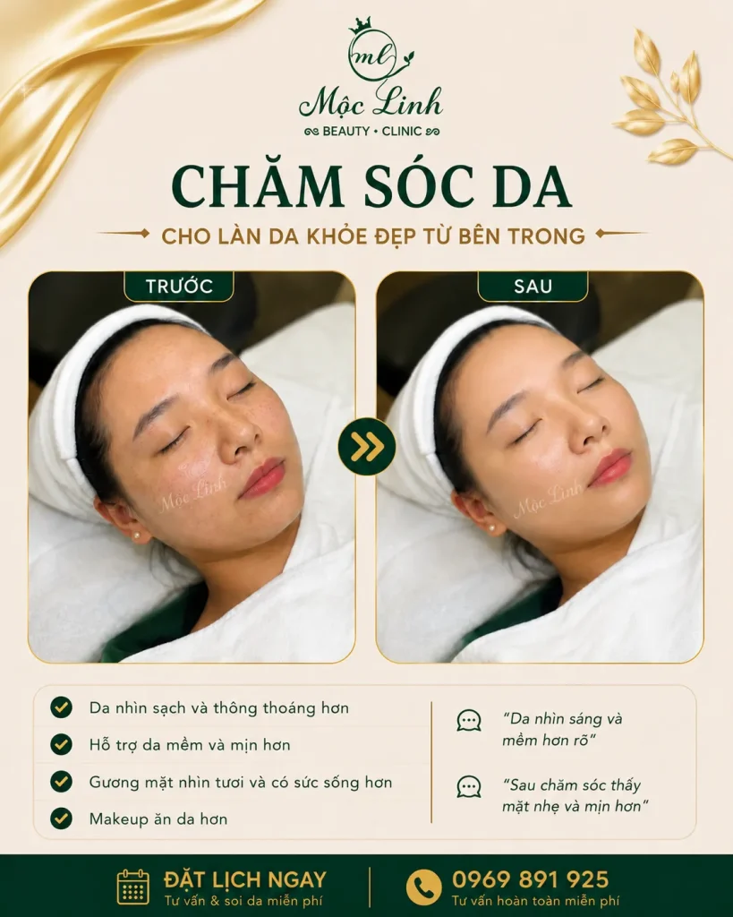 Chăm sóc da mặt tại Thẩm Mỹ Mộc Linh Hải Phòng - hình 8