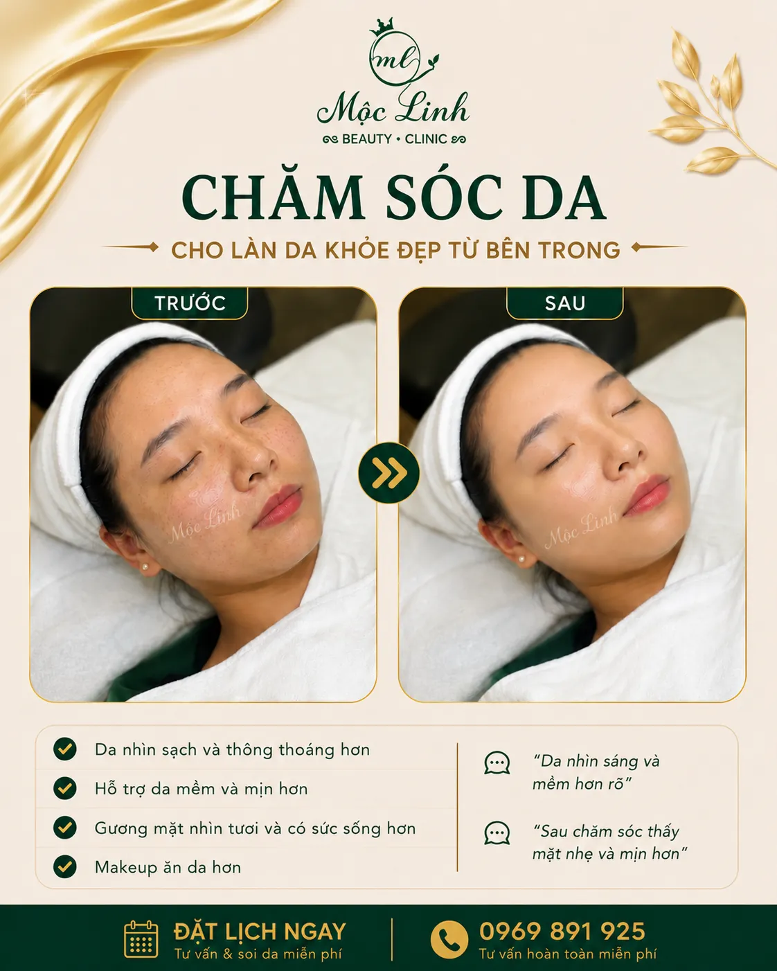 Chăm sóc da mặt tại Thẩm Mỹ Mộc Linh Hải Phòng - hình 4