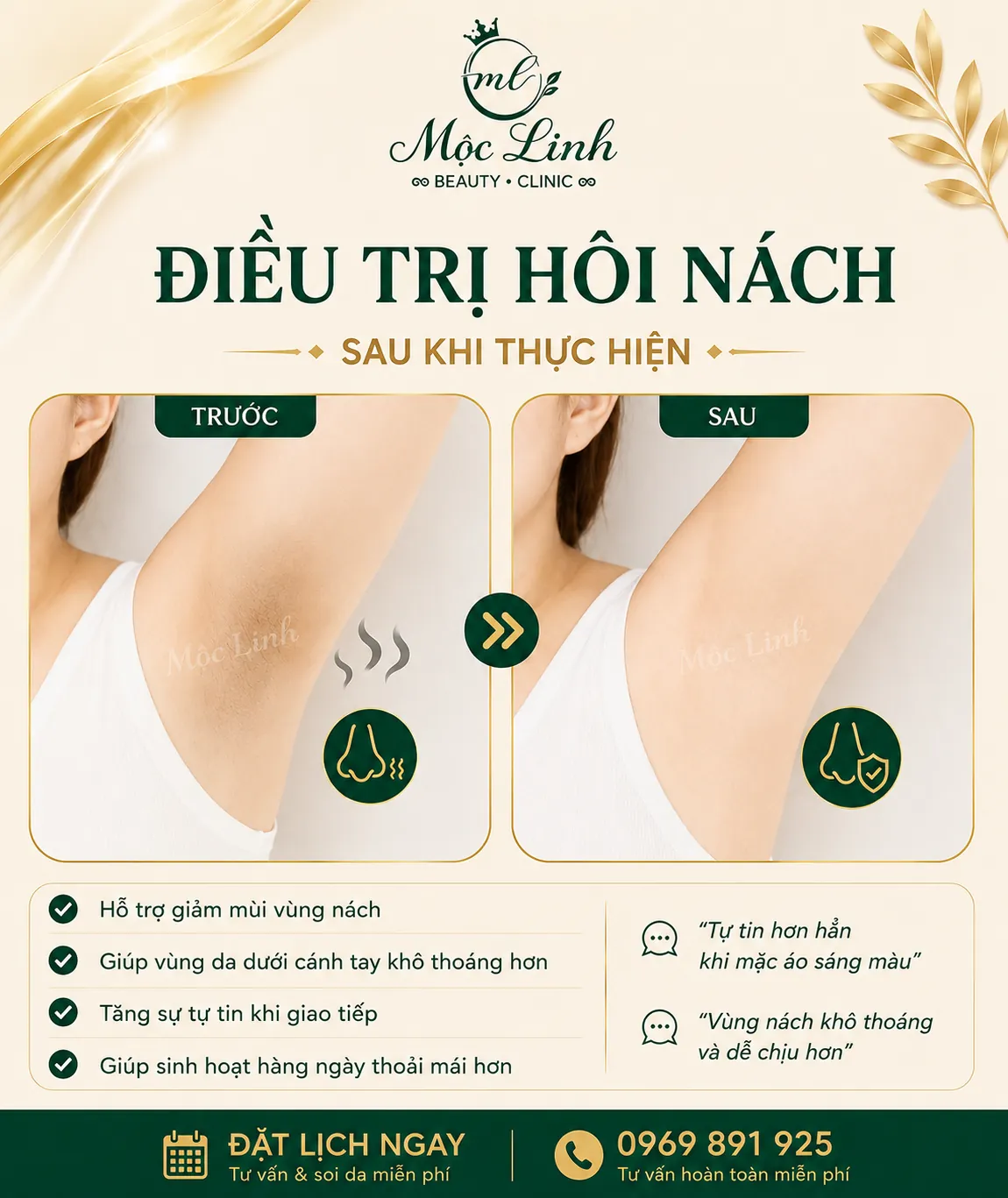 Trị hôi nách Hải Phòng tại Thẩm Mỹ Mộc Linh - hình 4