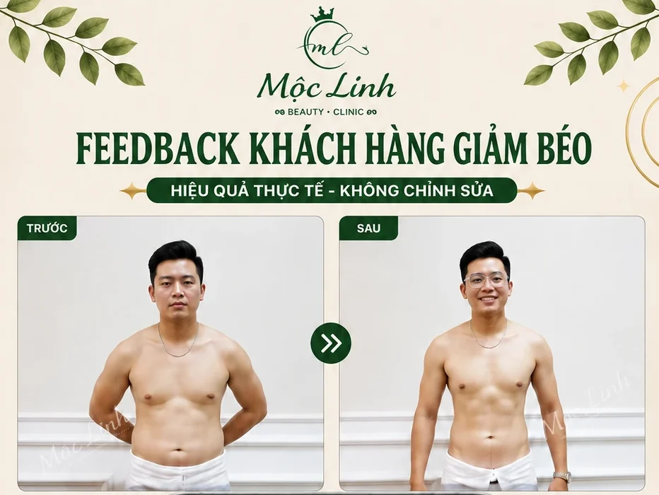 Giảm Béo An Toàn Hải Phòng tại Thẩm Mỹ Mộc Linh - hình 2