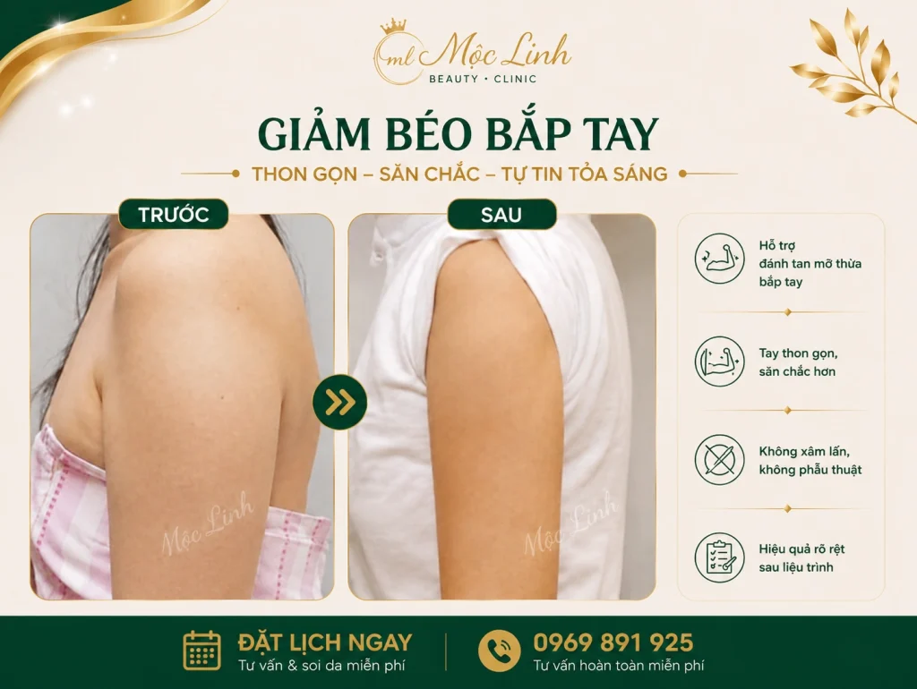 Giảm Béo An Toàn Hải Phòng tại Thẩm Mỹ Mộc Linh - hình 10