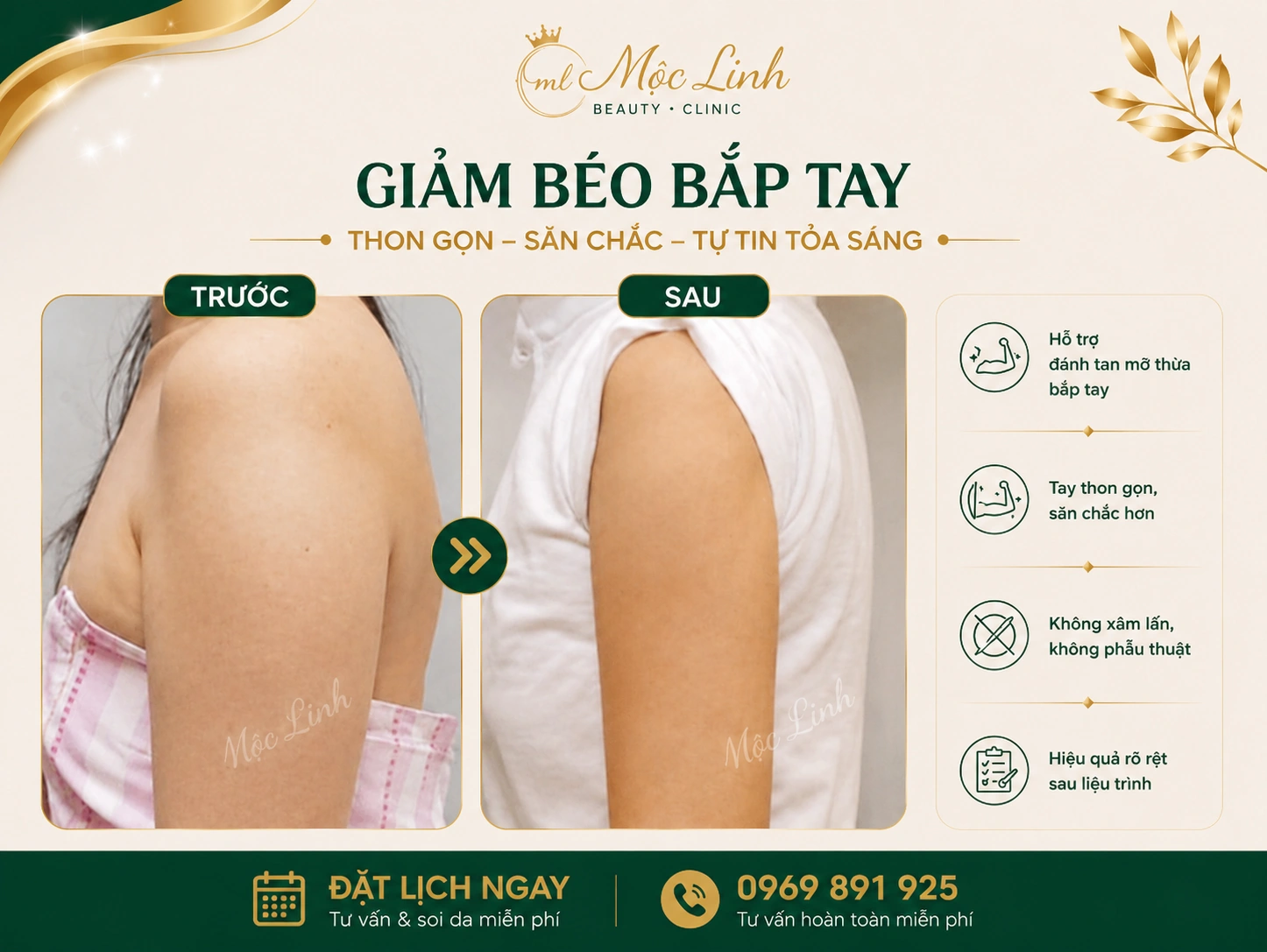 Giảm Béo An Toàn Hải Phòng tại Thẩm Mỹ Mộc Linh - hình 5