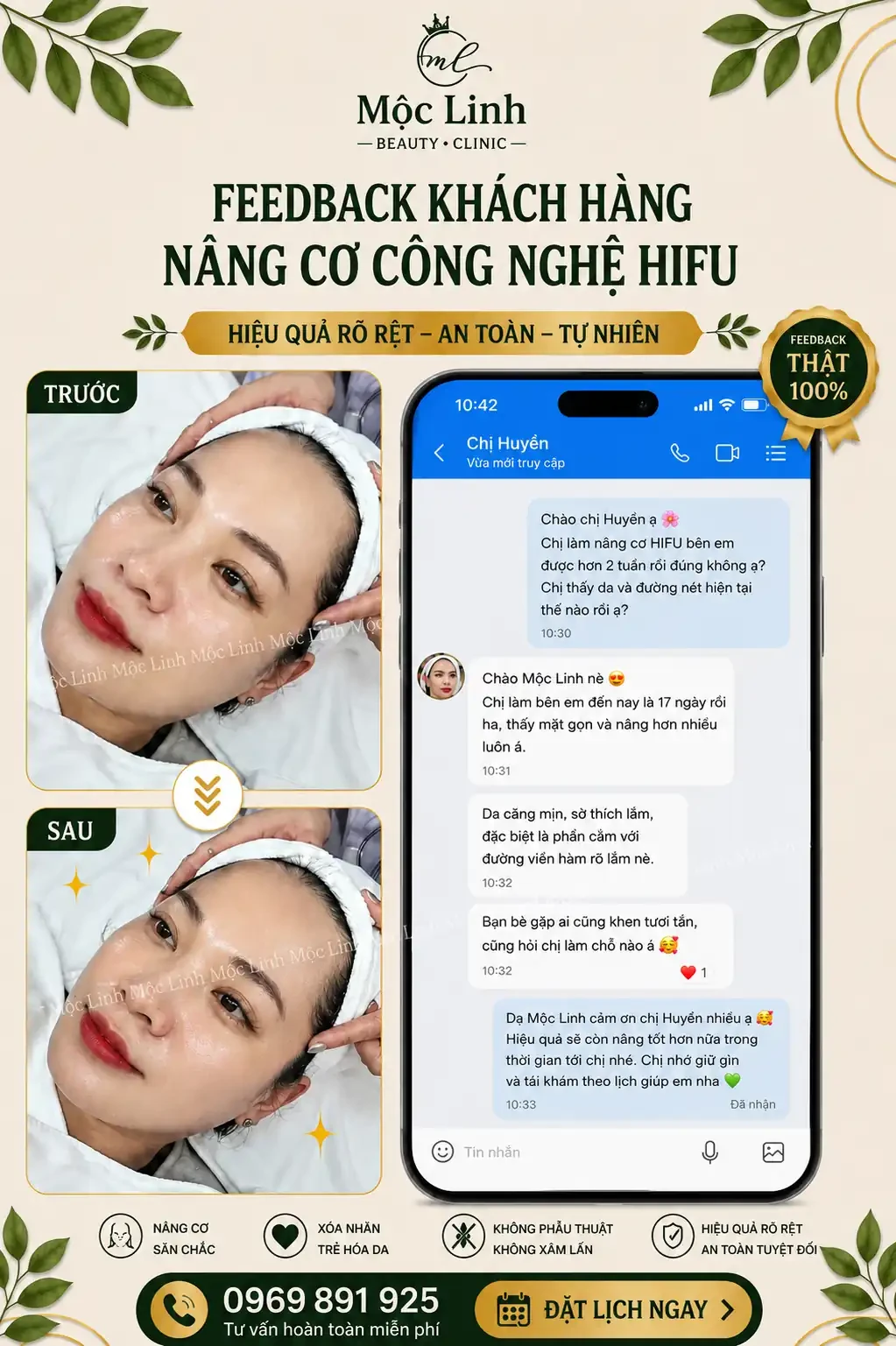 Nâng cơ công nghệ Hifu hiện đại bậc nhất tại Thẩm Mỹ Mộc Linh Hải Phòng - hình 5