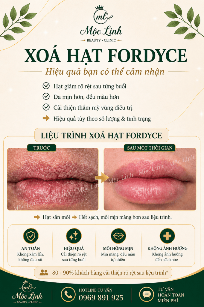 Xoá hạt Fordyce Hải Phòng tại Thẩm Mỹ Mộc Linh - hình 6