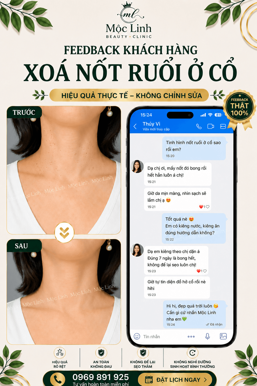 Xoá nốt ruồi an toàn Hải Phòng tại Thẩm Mỹ Mộc Linh - hình 6