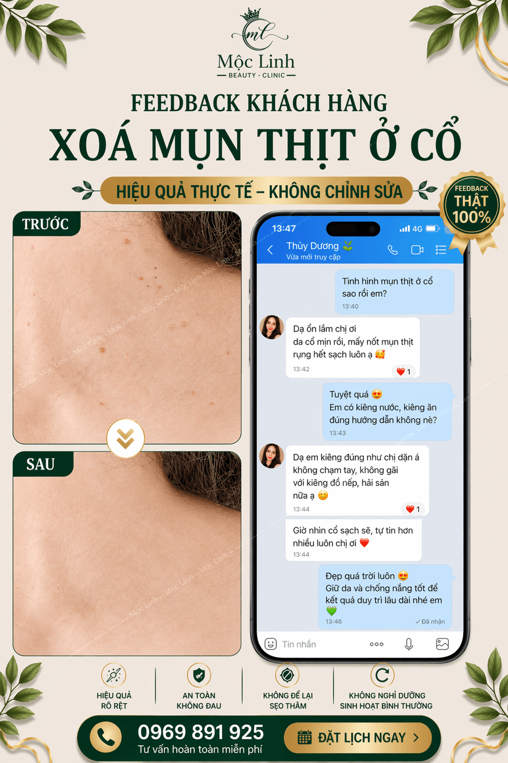 Điều trị mụn thịt uy tín tại Hải Phòng tại Thẩm Mỹ Mộc Linh - hình 5