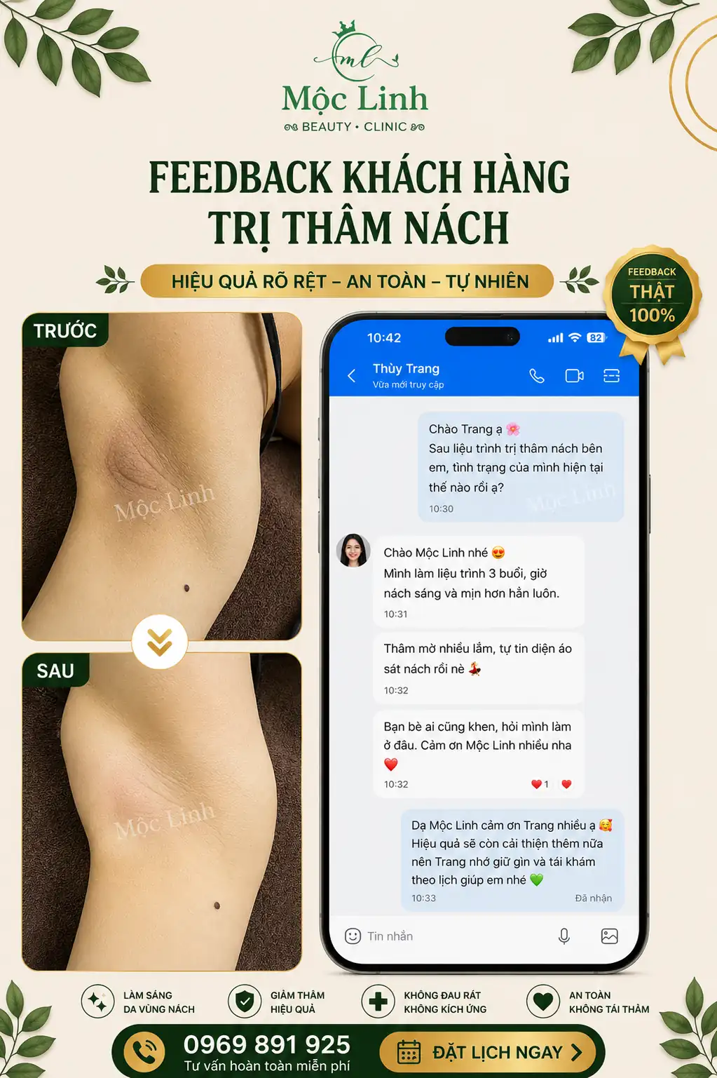 Trị thâm nách - bẹn Hải Phòng tại Thẩm Mỹ Mộc Linh - hình 5