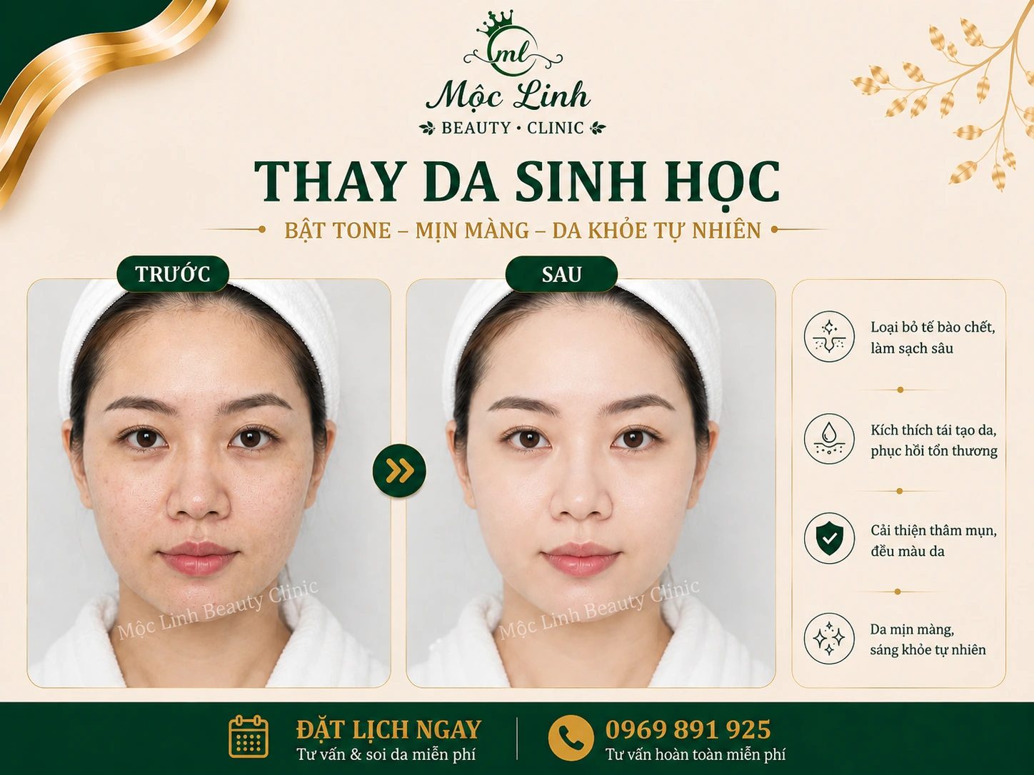 Hình ảnh thực tế dịch vụ thay da sinh học tại Hải Phòng