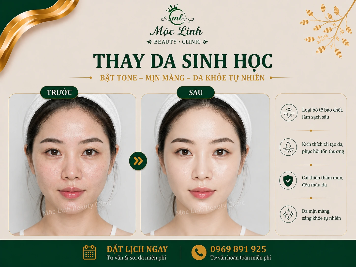 Kết quả thay da sinh học tại Thẩm Mỹ viện Mộc Linh