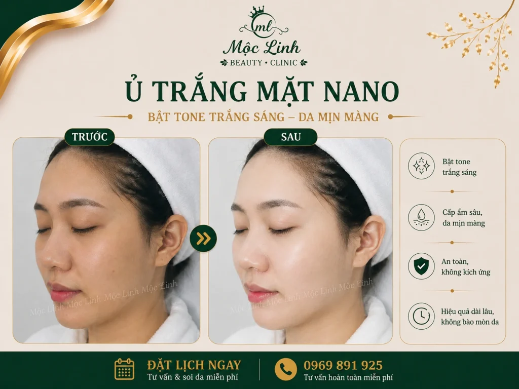Ủ Trắng Mặt Nano Hải Phòng – Khi Làn Da Xỉn Màu Cần tại Thẩm Mỹ Mộc Linh - hình 9