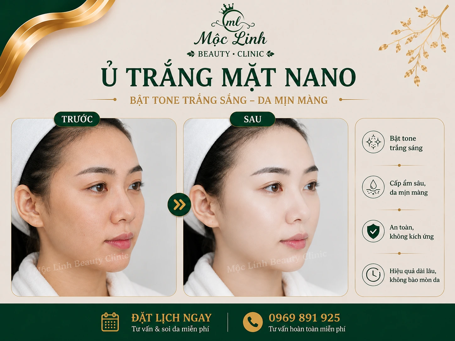Hình ảnh thực tế dịch vụ ủ trắng mặt nano tại Hải Phòng