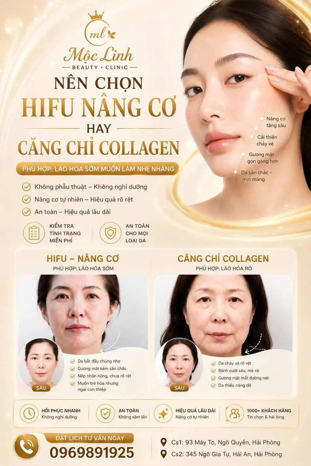 Nâng cơ Hifu và căng chỉ collagen tại Thẩm Mỹ Mộc Linh Hải Phòng - hình 1