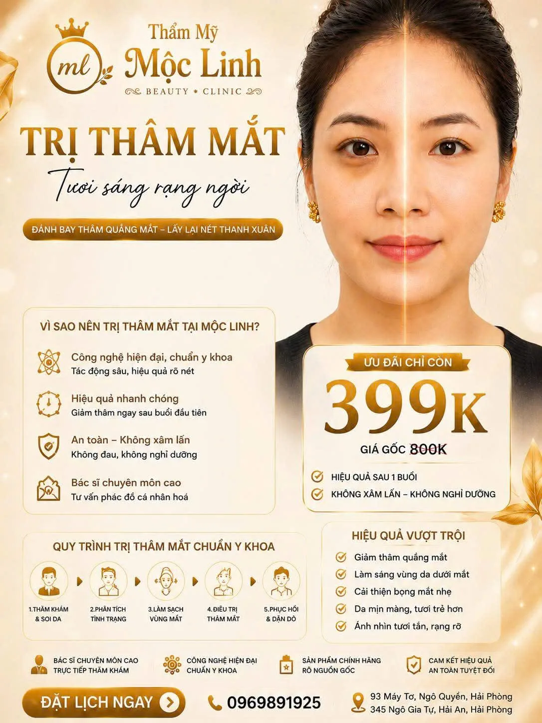 Trị thâm mắt giúp vùng mắt sáng khỏe tại Thẩm Mỹ Mộc Linh Hải Phòng