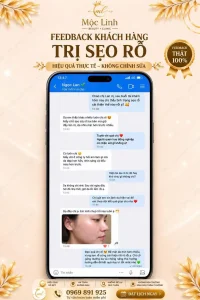 Formula trị sẹo rỗ - Trị mụn tại Thẩm mỹ viện Mộc Linh Hải Phòng